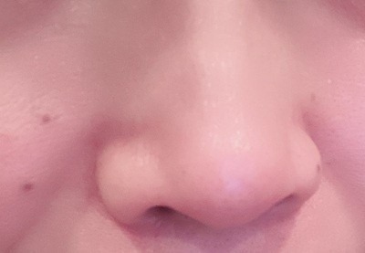 毛穴が消えた？！